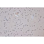 Immunohistochemistry - Anti-SRSF3 Antibody [ARC1394] (A307421) - Antibodies.com