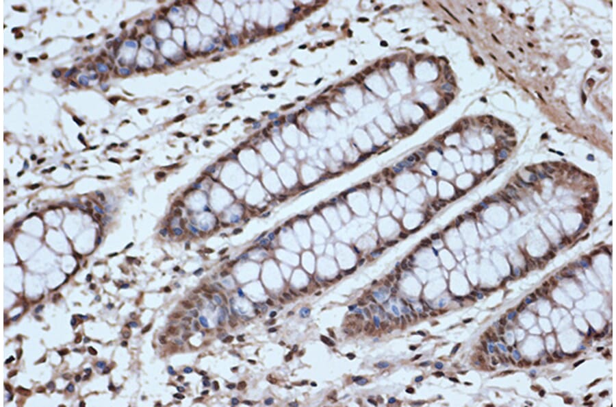 Immunohistochemistry - Anti-SRSF3 Antibody [ARC1394] (A307421) - Antibodies.com