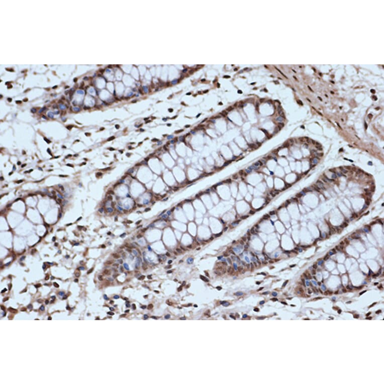 Immunohistochemistry - Anti-SRSF3 Antibody [ARC1394] (A307421) - Antibodies.com