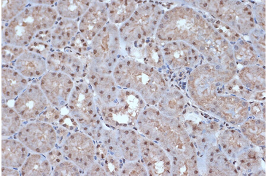 Immunohistochemistry - Anti-SRSF3 Antibody [ARC1394] (A307421) - Antibodies.com