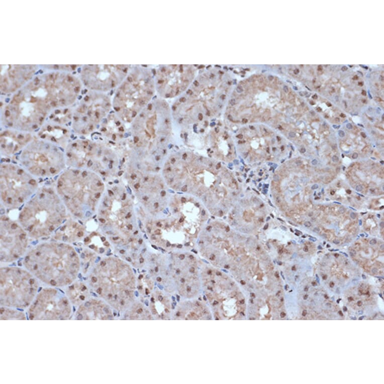 Immunohistochemistry - Anti-SRSF3 Antibody [ARC1394] (A307421) - Antibodies.com