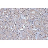 Immunohistochemistry - Anti-SRSF3 Antibody [ARC1394] (A307421) - Antibodies.com
