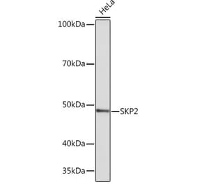 Western Blot - Anti-SKP2 Antibody [ARC0886] (A307422) - Antibodies.com