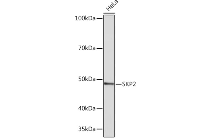 Western Blot - Anti-SKP2 Antibody [ARC0886] (A307422) - Antibodies.com