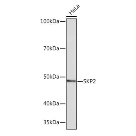 Western Blot - Anti-SKP2 Antibody [ARC0886] (A307422) - Antibodies.com