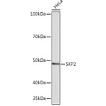 Western Blot - Anti-SKP2 Antibody [ARC0886] (A307422) - Antibodies.com