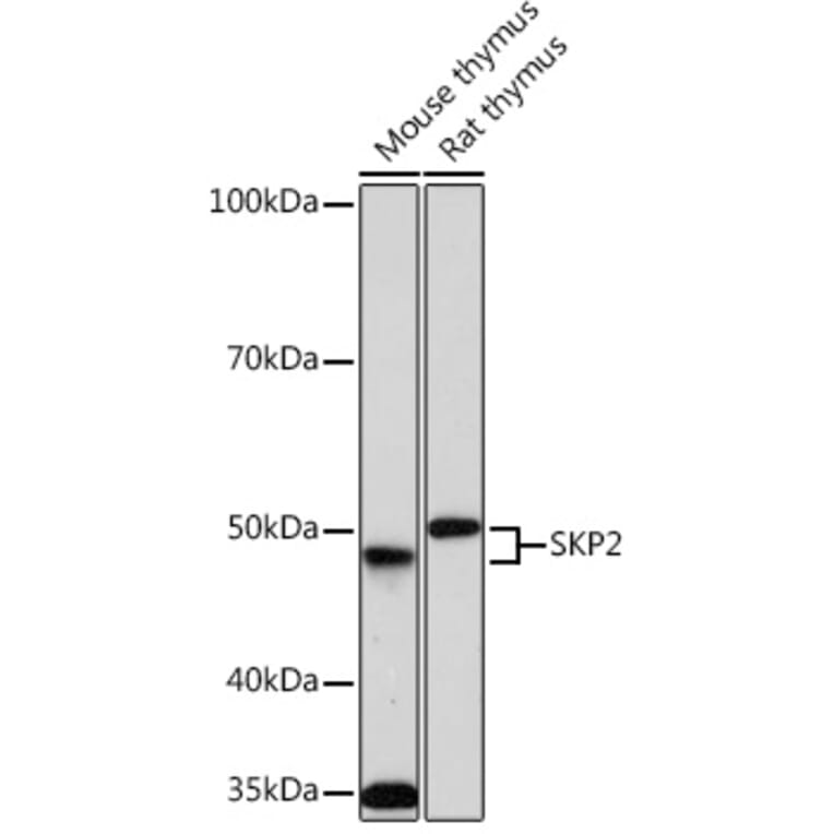 Western Blot - Anti-SKP2 Antibody [ARC0886] (A307422) - Antibodies.com