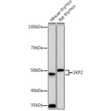 Western Blot - Anti-SKP2 Antibody [ARC0886] (A307422) - Antibodies.com