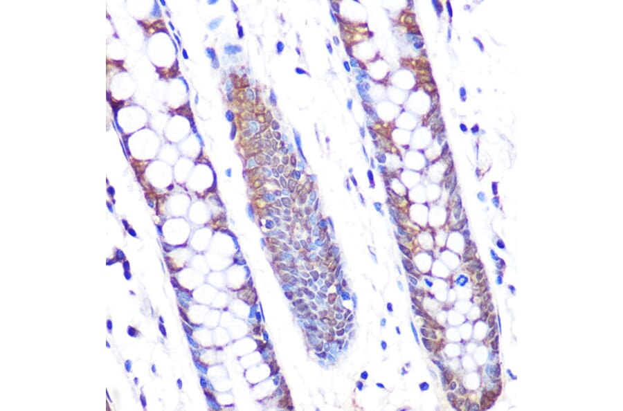 Immunohistochemistry - Anti-SKP2 Antibody [ARC0886] (A307422) - Antibodies.com