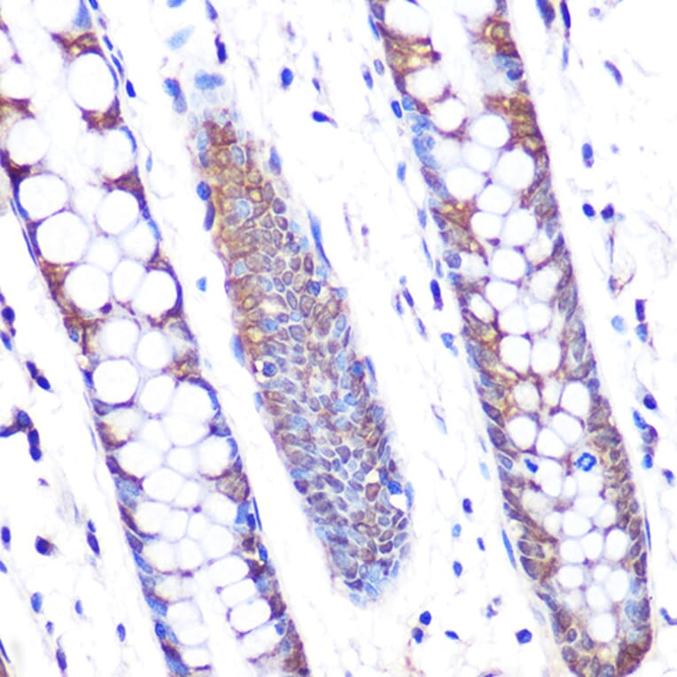 Immunohistochemistry - Anti-SKP2 Antibody [ARC0886] (A307422) - Antibodies.com