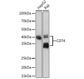Western Blot - Anti-CD74 Antibody [ARC1452] (A307423) - Antibodies.com