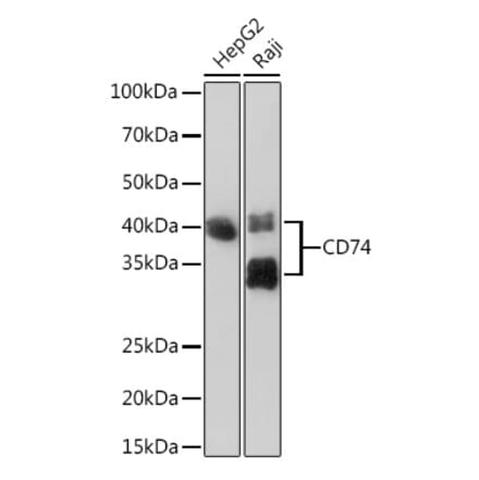 Western Blot - Anti-CD74 Antibody [ARC1452] (A307423) - Antibodies.com