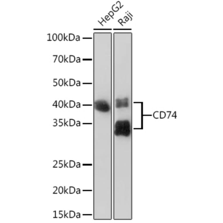 Western Blot - Anti-CD74 Antibody [ARC1452] (A307423) - Antibodies.com