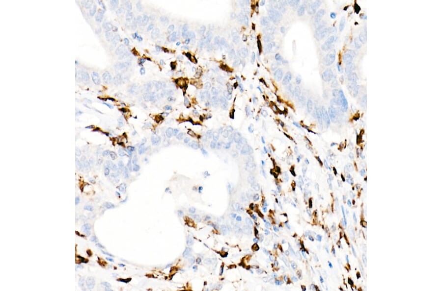 Immunohistochemistry - Anti-CD74 Antibody [ARC1452] (A307423) - Antibodies.com