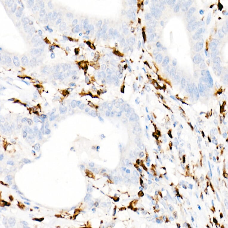 Immunohistochemistry - Anti-CD74 Antibody [ARC1452] (A307423) - Antibodies.com