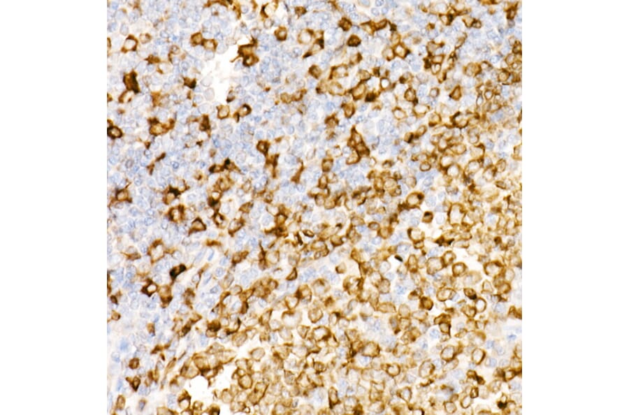 Immunohistochemistry - Anti-CD74 Antibody [ARC1452] (A307423) - Antibodies.com