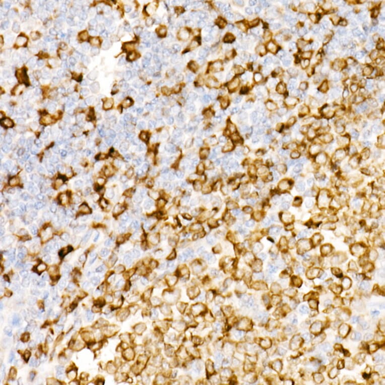 Immunohistochemistry - Anti-CD74 Antibody [ARC1452] (A307423) - Antibodies.com