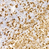 Immunohistochemistry - Anti-CD74 Antibody [ARC1452] (A307423) - Antibodies.com