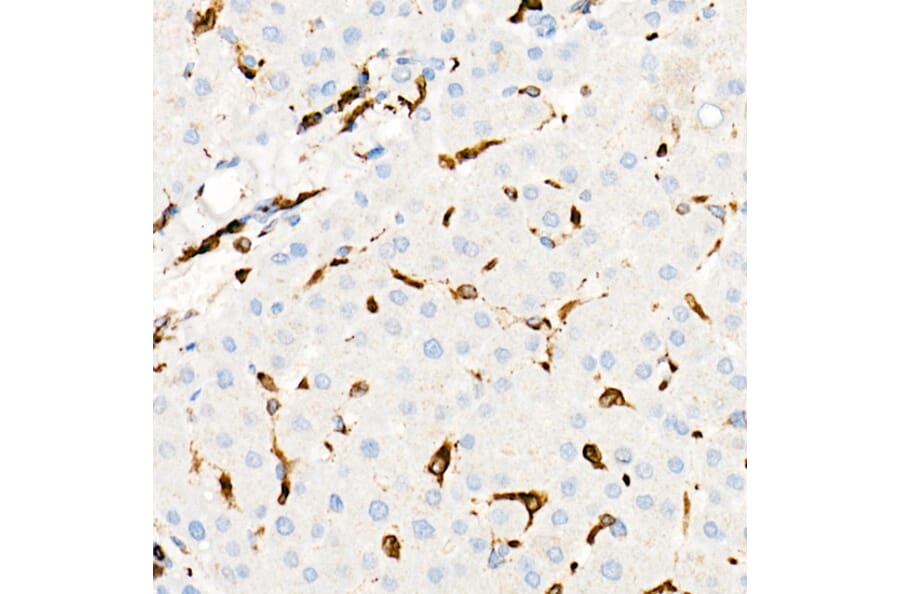 Immunohistochemistry - Anti-CD74 Antibody [ARC1452] (A307423) - Antibodies.com