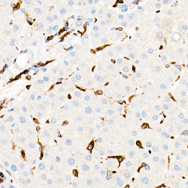 Immunohistochemistry - Anti-CD74 Antibody [ARC1452] (A307423) - Antibodies.com