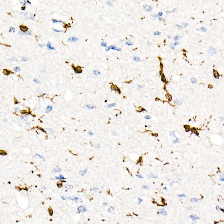 Immunohistochemistry - Anti-CD74 Antibody [ARC1452] (A307423) - Antibodies.com