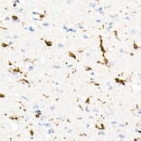 Immunohistochemistry - Anti-CD74 Antibody [ARC1452] (A307423) - Antibodies.com