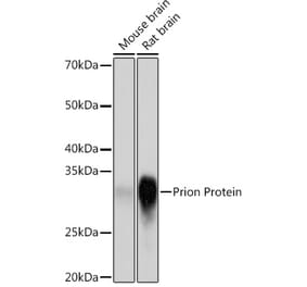 Western Blot - Anti-Prion protein PrP Antibody [ARC1315] (A307424) - Antibodies.com