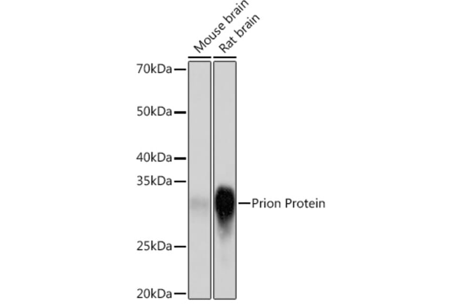 Western Blot - Anti-Prion protein PrP Antibody [ARC1315] (A307424) - Antibodies.com