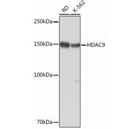 Western Blot - Anti-HDAC9 Antibody [ARC0735] (A307425) - Antibodies.com