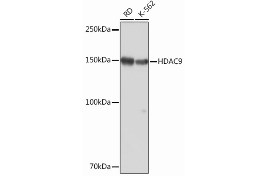 Western Blot - Anti-HDAC9 Antibody [ARC0735] (A307425) - Antibodies.com