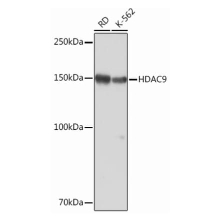 Western Blot - Anti-HDAC9 Antibody [ARC0735] (A307425) - Antibodies.com