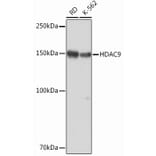 Western Blot - Anti-HDAC9 Antibody [ARC0735] (A307425) - Antibodies.com