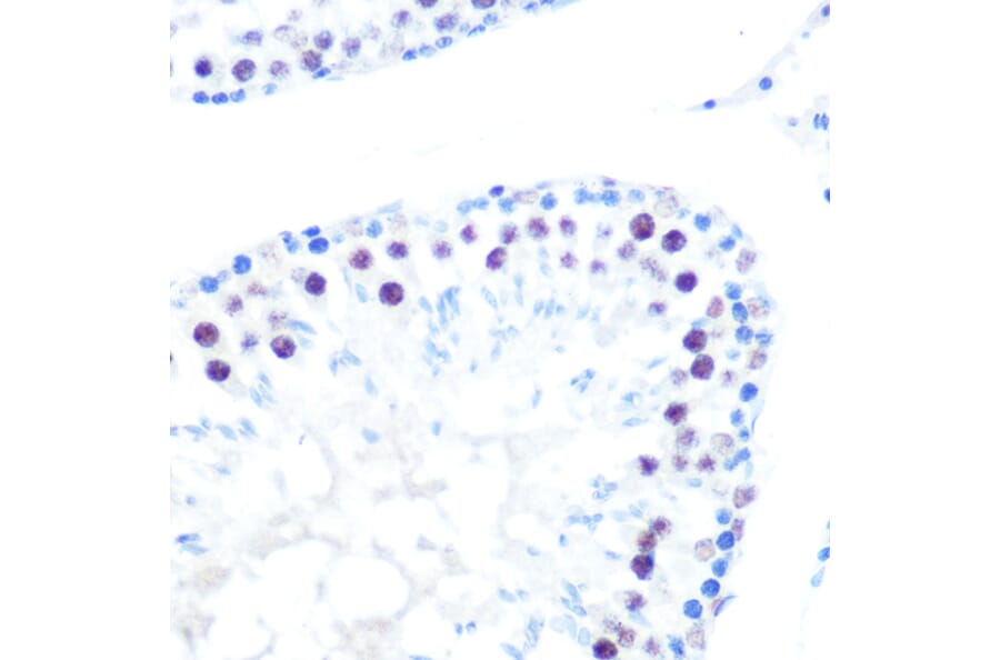 Immunohistochemistry - Anti-HDAC9 Antibody [ARC0735] (A307425) - Antibodies.com