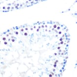 Immunohistochemistry - Anti-HDAC9 Antibody [ARC0735] (A307425) - Antibodies.com