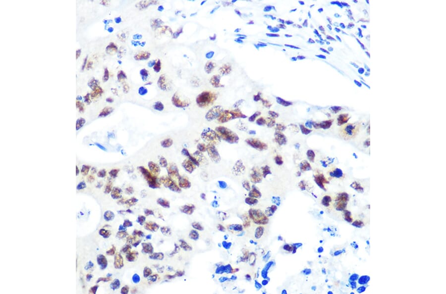 Immunohistochemistry - Anti-HDAC9 Antibody [ARC0735] (A307425) - Antibodies.com