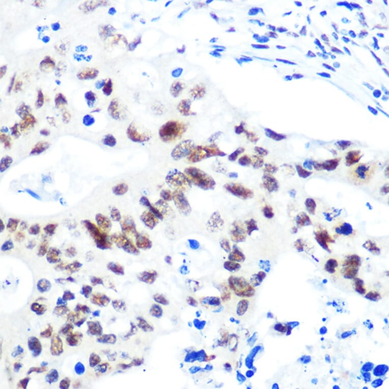 Immunohistochemistry - Anti-HDAC9 Antibody [ARC0735] (A307425) - Antibodies.com