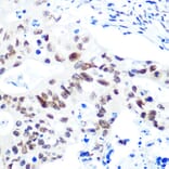 Immunohistochemistry - Anti-HDAC9 Antibody [ARC0735] (A307425) - Antibodies.com