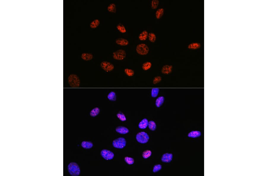 Immunofluorescence - Anti-HDAC9 Antibody [ARC0735] (A307425) - Antibodies.com