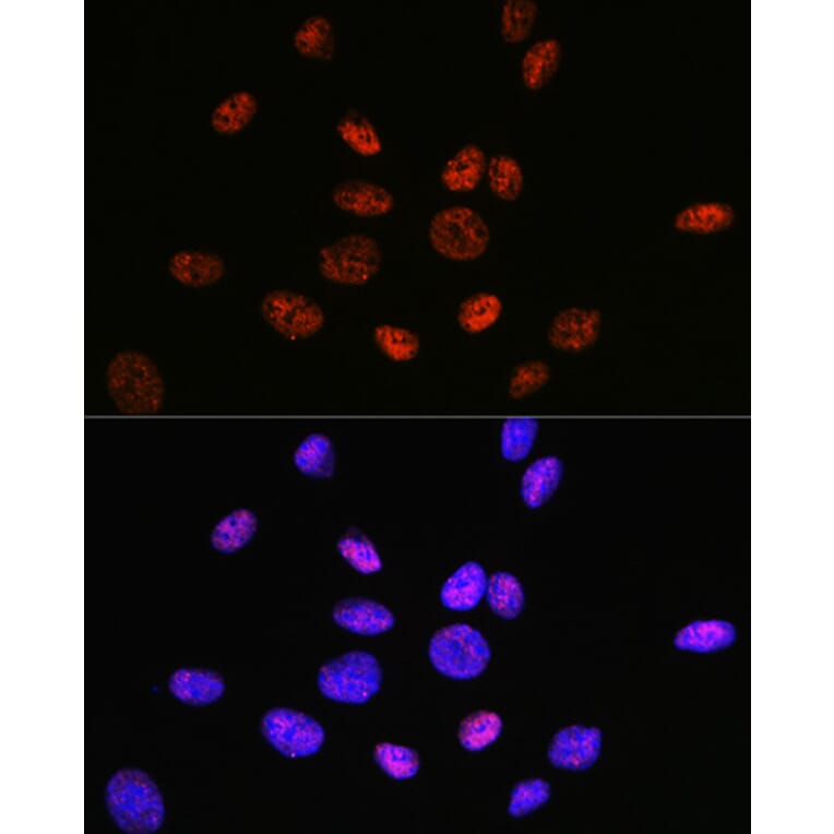 Immunofluorescence - Anti-HDAC9 Antibody [ARC0735] (A307425) - Antibodies.com