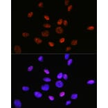 Immunofluorescence - Anti-HDAC9 Antibody [ARC0735] (A307425) - Antibodies.com