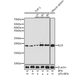 Western Blot - Anti-IL-10 Antibody [ARC0650] (A307426) - Antibodies.com