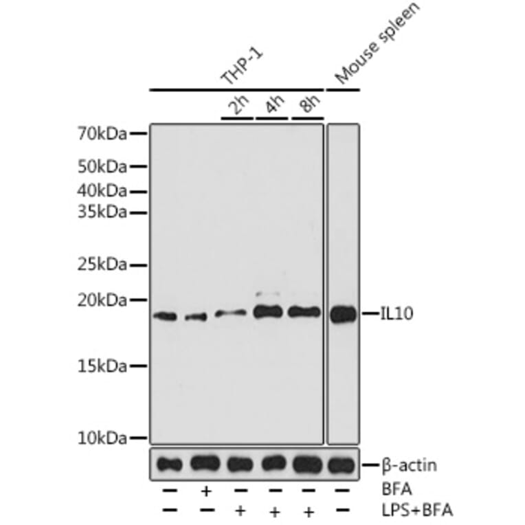 Western Blot - Anti-IL-10 Antibody [ARC0650] (A307426) - Antibodies.com