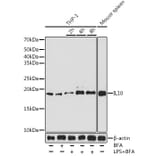 Western Blot - Anti-IL-10 Antibody [ARC0650] (A307426) - Antibodies.com