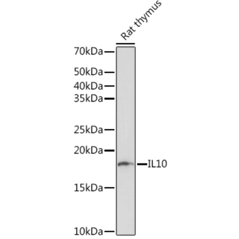 Western Blot - Anti-IL-10 Antibody [ARC0650] (A307426) - Antibodies.com