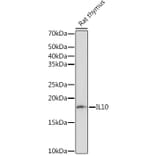 Western Blot - Anti-IL-10 Antibody [ARC0650] (A307426) - Antibodies.com