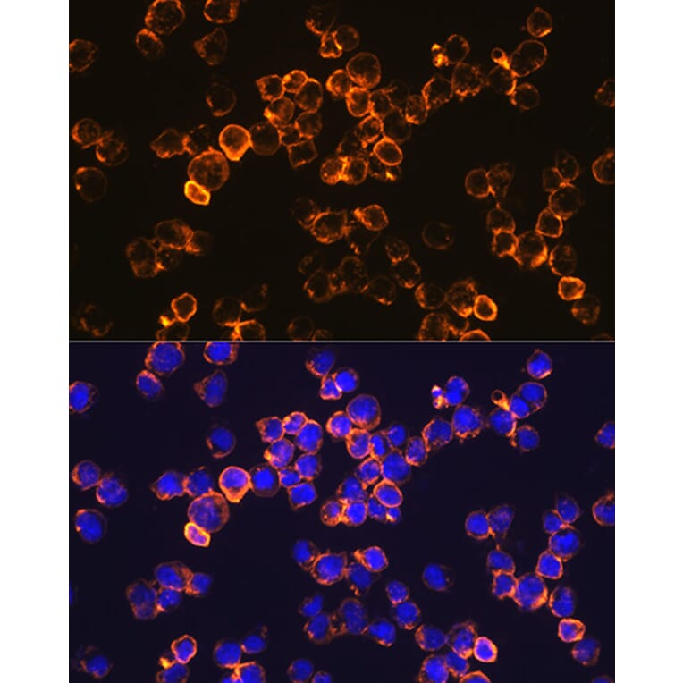 Immunofluorescence - Anti-IL-10 Antibody [ARC0650] (A307426) - Antibodies.com