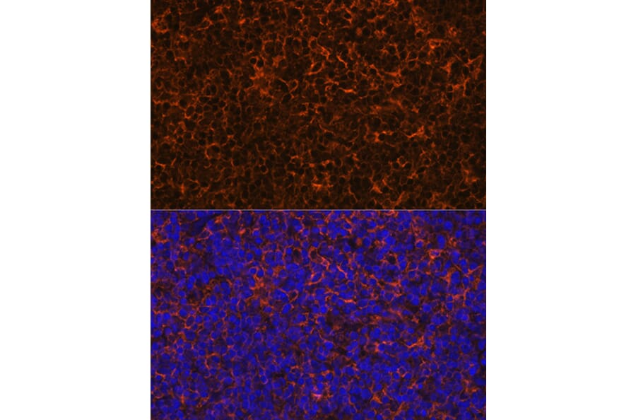 Immunofluorescence - Anti-IL-10 Antibody [ARC0650] (A307426) - Antibodies.com