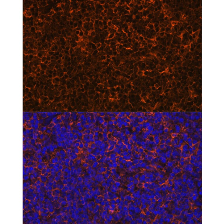 Immunofluorescence - Anti-IL-10 Antibody [ARC0650] (A307426) - Antibodies.com