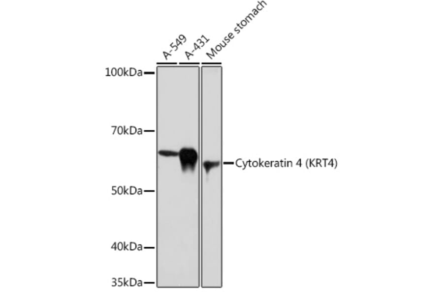 Western Blot - Anti-Cytokeratin 4 Antibody [ARC1804] (A307427) - Antibodies.com
