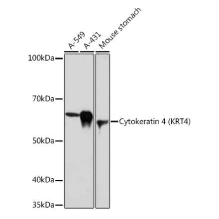 Western Blot - Anti-Cytokeratin 4 Antibody [ARC1804] (A307427) - Antibodies.com